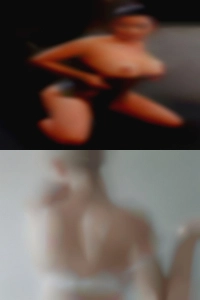 Appendix fuck scar sexy girls.